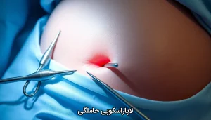 لاپاراسکوپی حاملگی