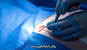 روش لاپاراسکوپی رحم
